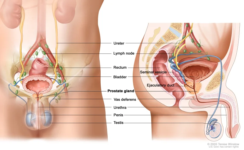 Male Genito Urinary cancer