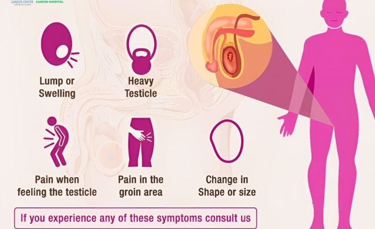 Testicular-Cancer